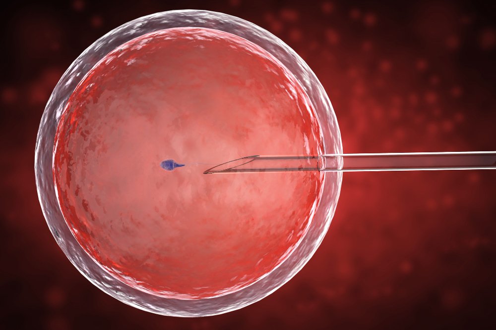 Blastocyst Transfer