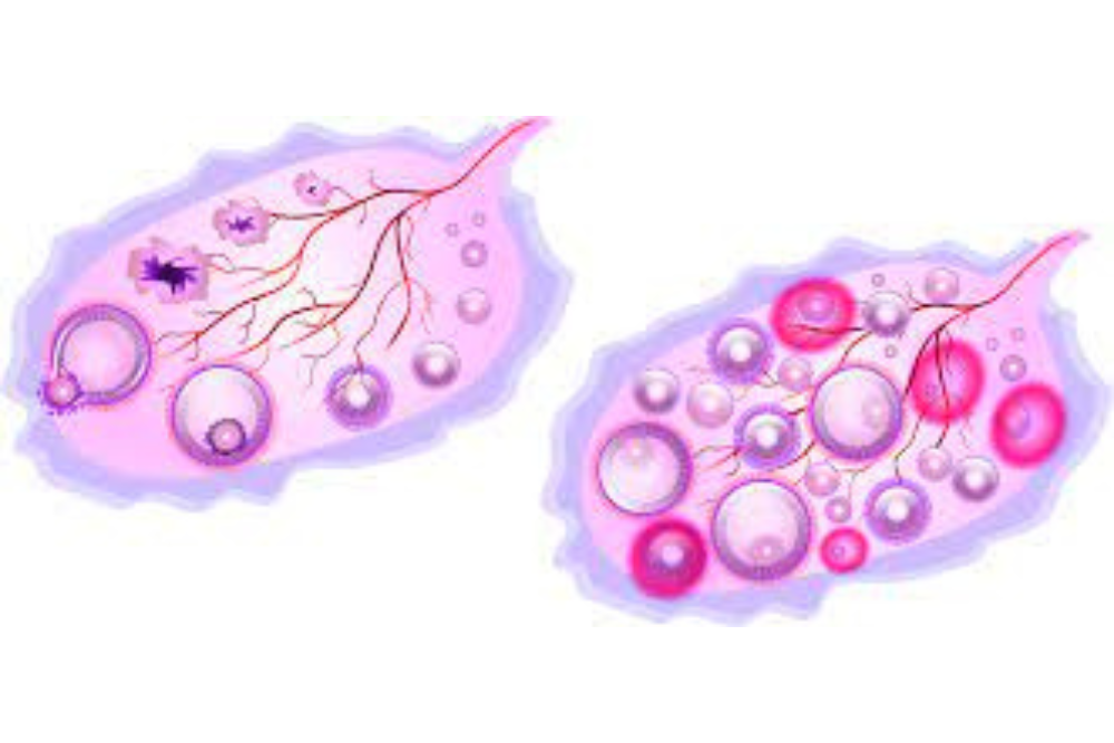 Ovulation Induction and Cycle Monitoring